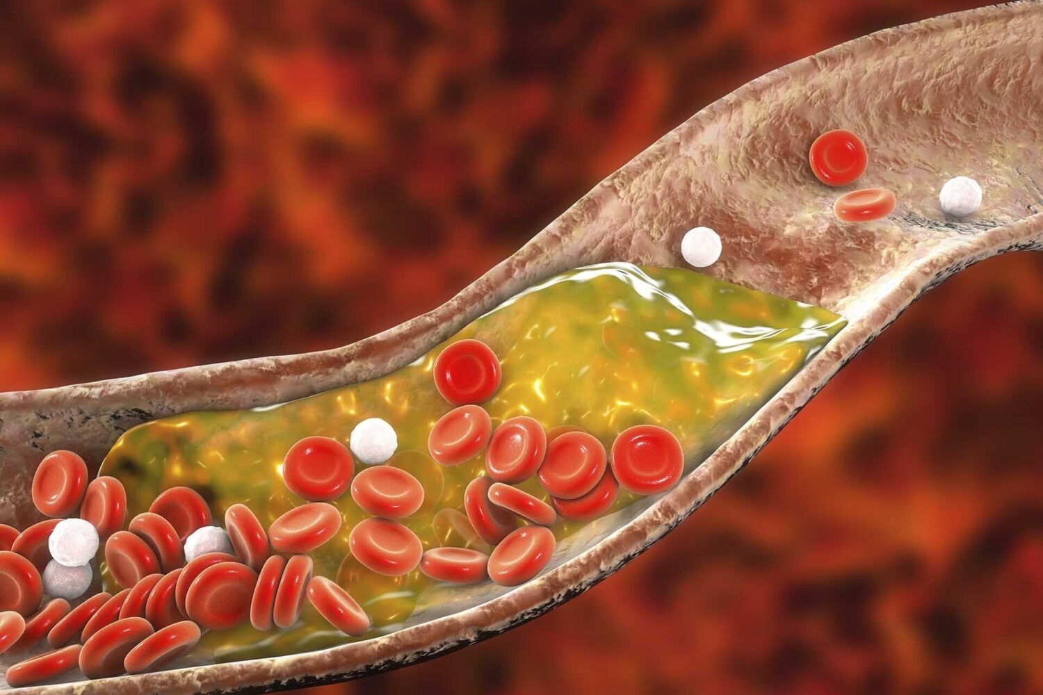 Hiểu rõ vai trò của cholesterol là gì để chủ động kiểm soát chỉ số này