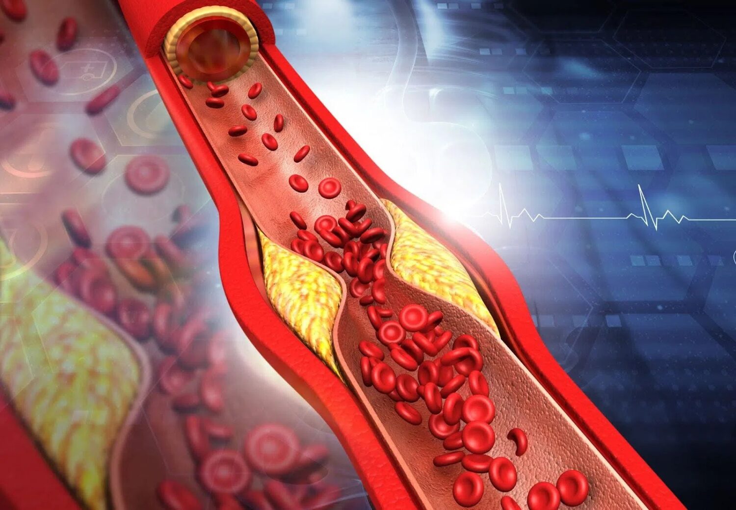 Thực phẩm giảm cholesterol